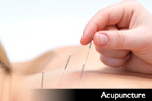 Acupuncture